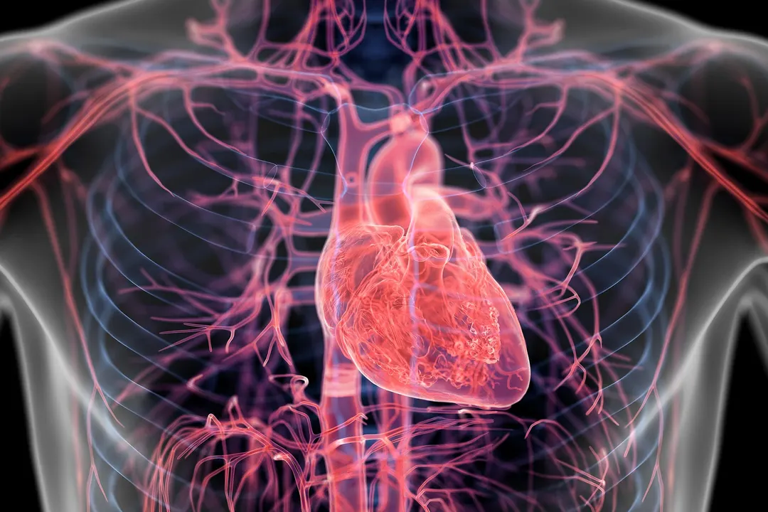 Hidden Artery Plaque Found in 1 in 13 Adults Before Age 30