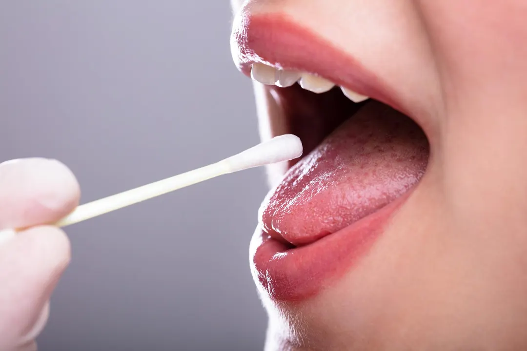 Saliva Test Links Cortisol Patterns to Faster Cognitive Decline