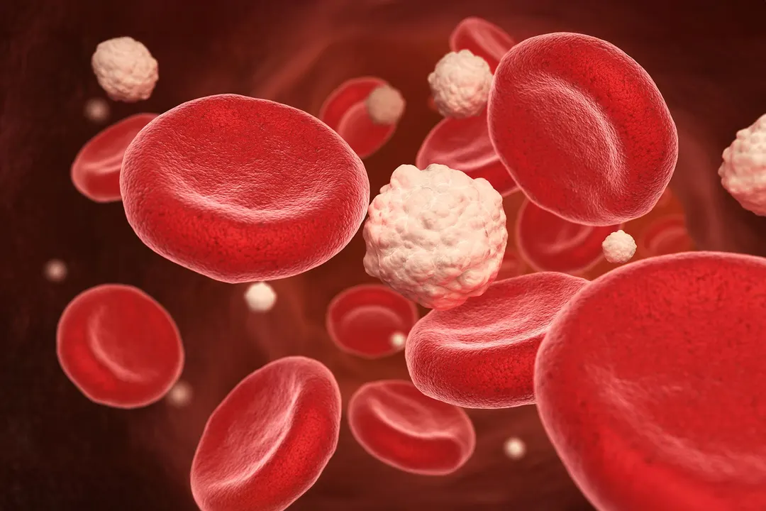 CGM Links Blood Sugar Patterns to Blood Pressure and Cholesterol in Healthy Adults