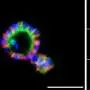 Mini salivary glands grown from pluripotent stem cells