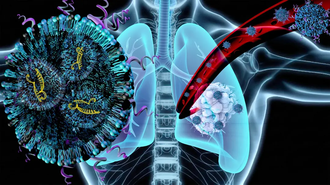 Nanoparticles with mRNA target lung cancer and muscle wasting at once