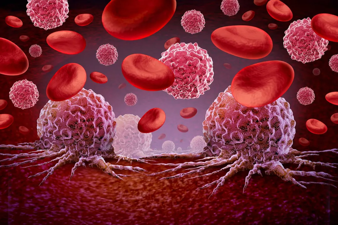 Vitamin C trial EVITA shows fewer adverse events in pre-leukemia disorders