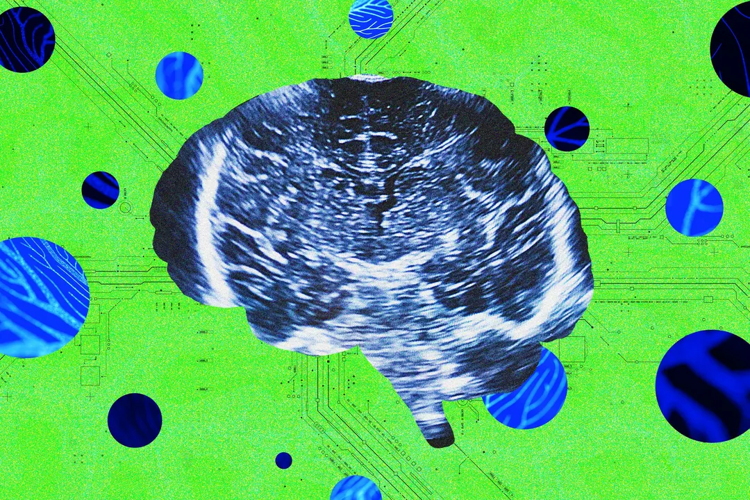Bridge Neurotech launches with $13.5M for ultrasound brain interface