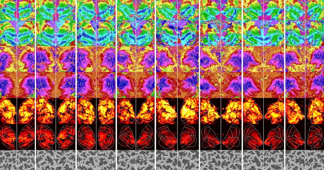 New AI Recreates Images From Brain Scans With High Fidelity