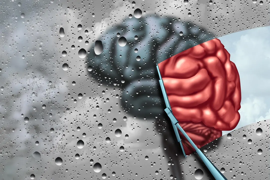 Rare FN1 Mutation May Shield the Brain From Alzheimer's Damage
