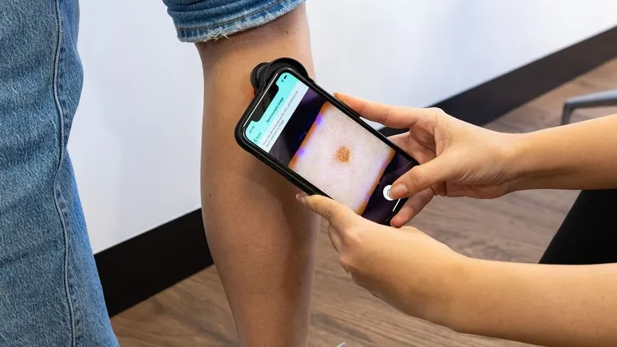 NHS South East rolls out autonomous skin cancer AI that can discharge patients
