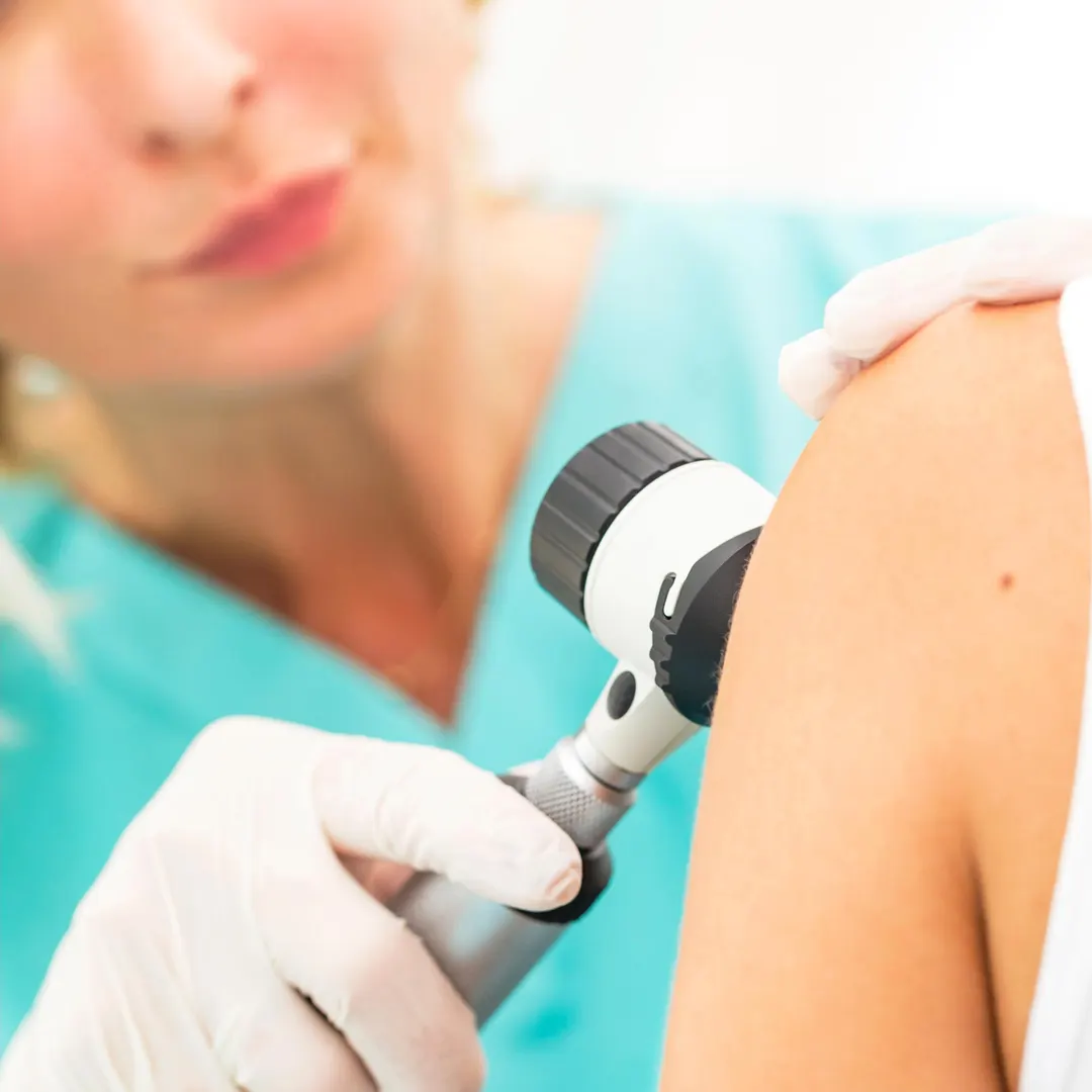 AI Skin Scanner Detects Hidden Cancer Before It's Visible