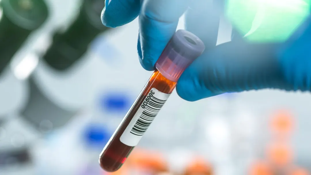 Scientists find blood 'protein signature' that may predict healthy aging