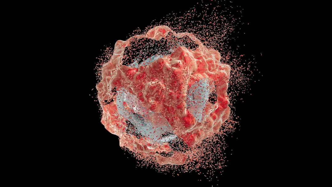 Immunotherapy before surgery kept bowel cancer away for 33 months