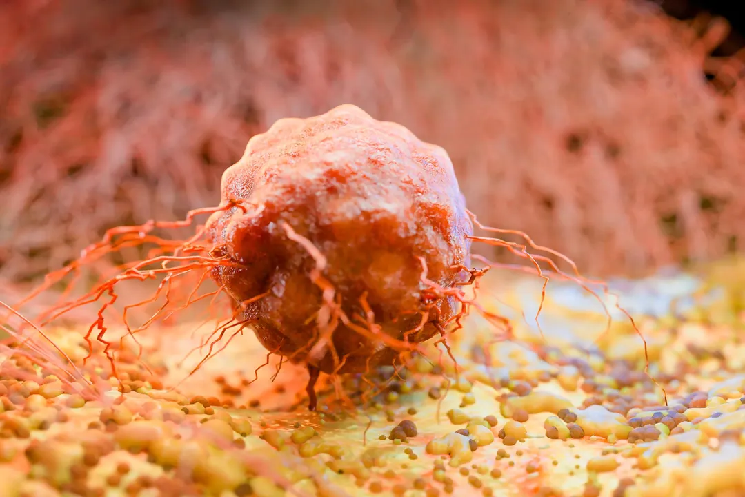 Mayo Clinic links gut bacteria to cancer survival and chemo side effects