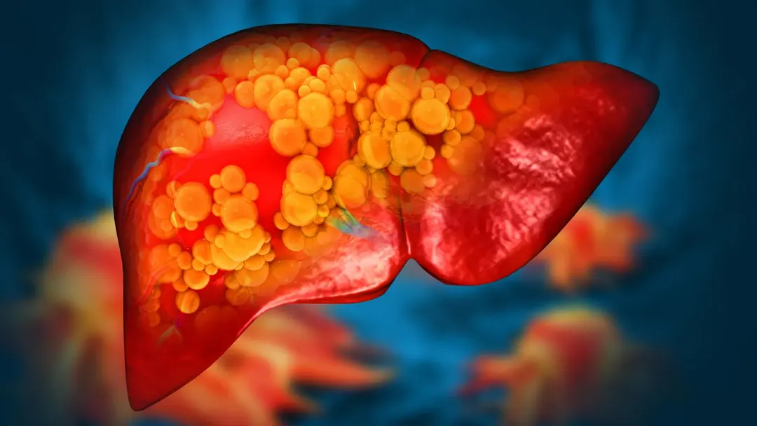 Polyethylene microplastics linked to fatty liver disease