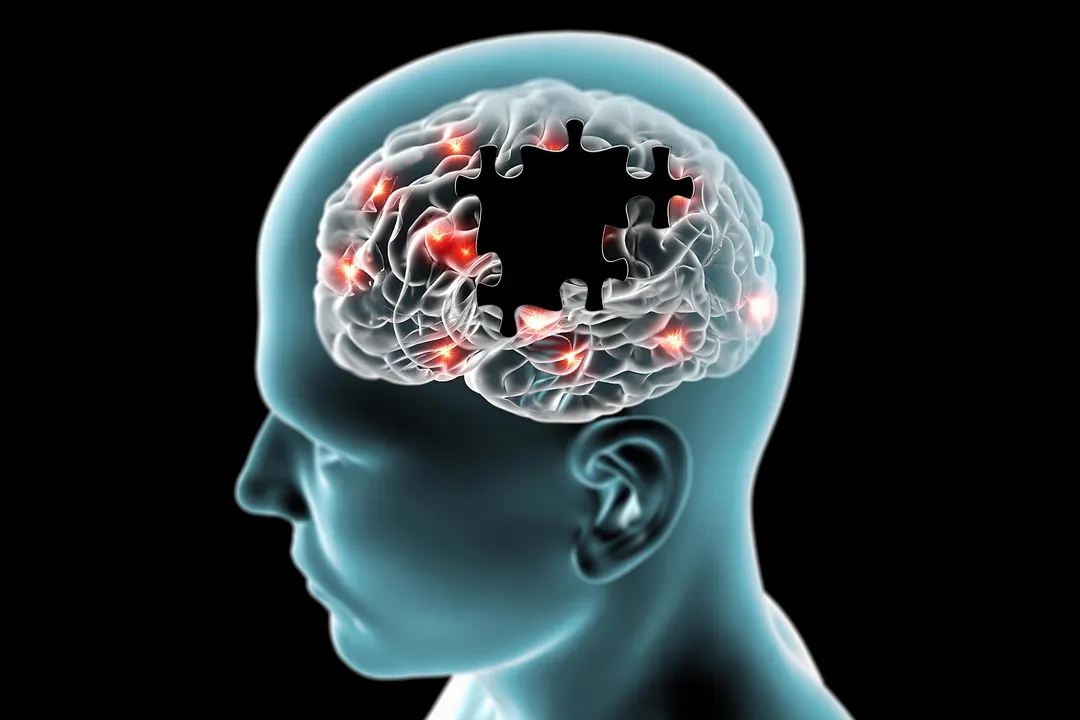 Rapamycin Improved Brain Blood Flow in APOE4 Carriers