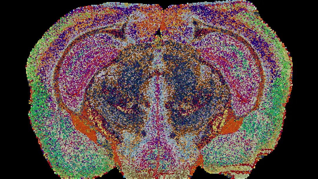 EPFL scientists map the brain's lipids into 539 distinct zones