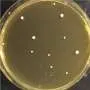 Candida auris copies its entire genome to survive antifungal treatment