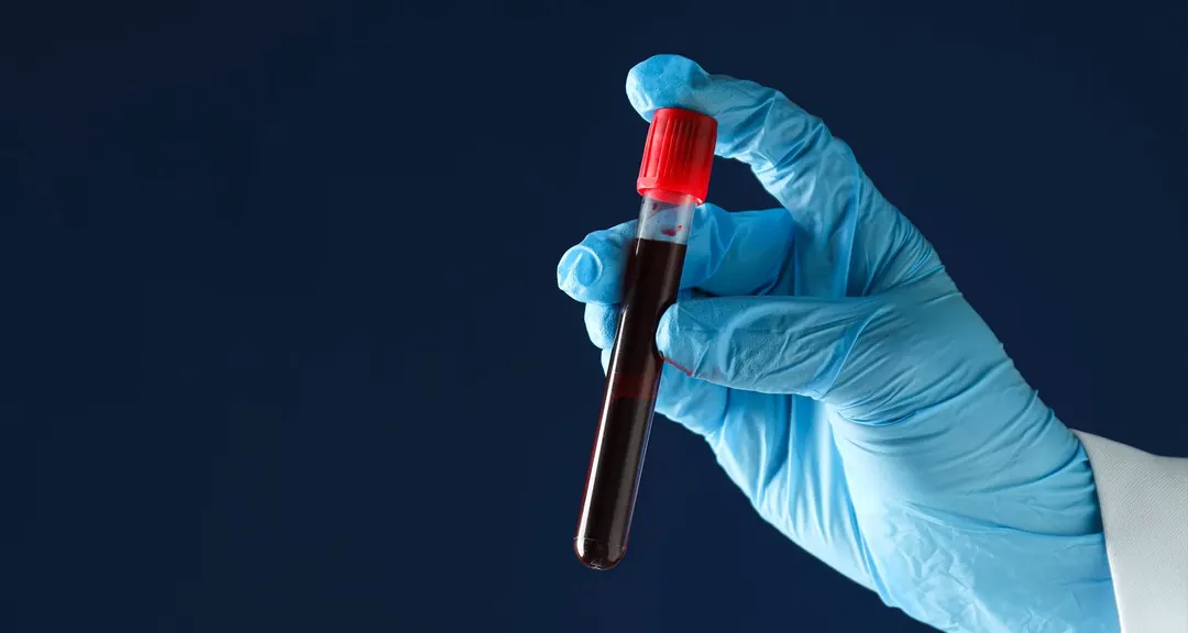 Ampath says no evidence test results were stolen in cyberattack