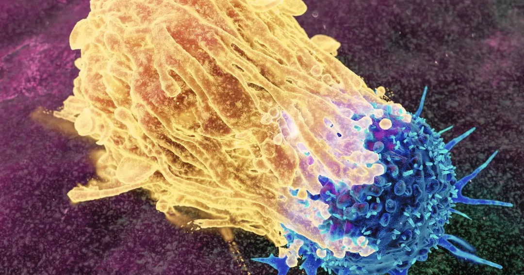Gamma delta T cells offer new way to attack small cell lung cancer