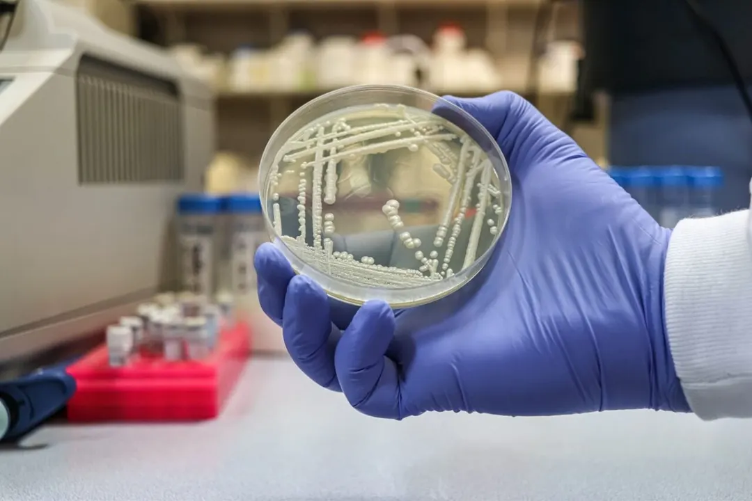 Kenya Reports Candidozyma auris Resistant to All Major Antifungal Drugs