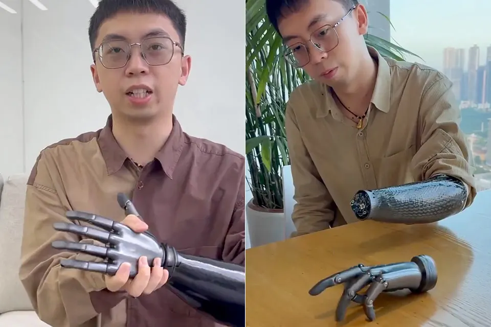 BrainCo unveils bionic hand that turns neural and muscle signals into finger control
