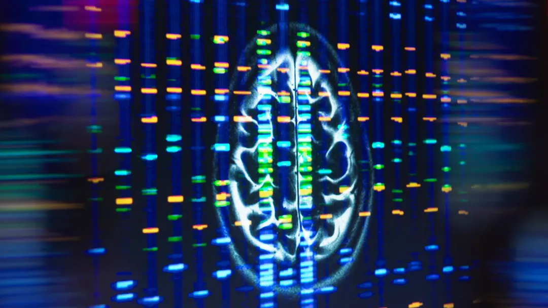 Study links APOE4 Alzheimer's risk to fat buildup in brain cells