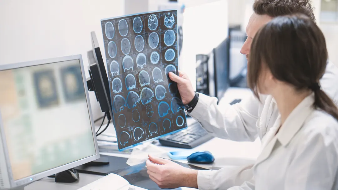Inhaling high-dose CO2 cleared Alzheimer's tau protein in small study