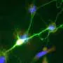 NASTIC tech tracks proteins in living neurons for neurodegenerative drug discovery