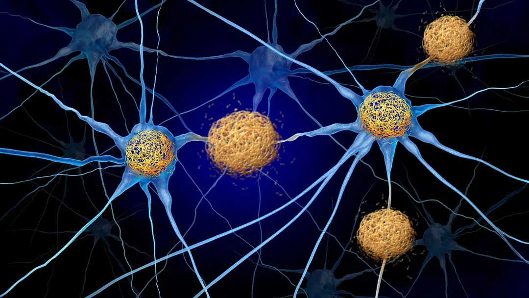 CXCR3 antibody protects mouse brains from tauopathy damage