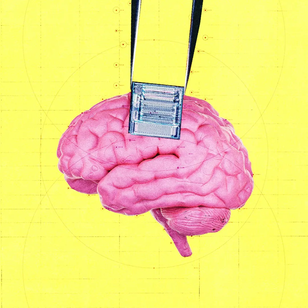 OpenAI backs startup using brain implants to detect cancer