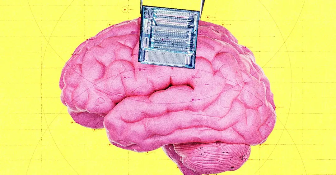Coherence Neuro raises $45M seed for AI and brain implants to fight brain tumors