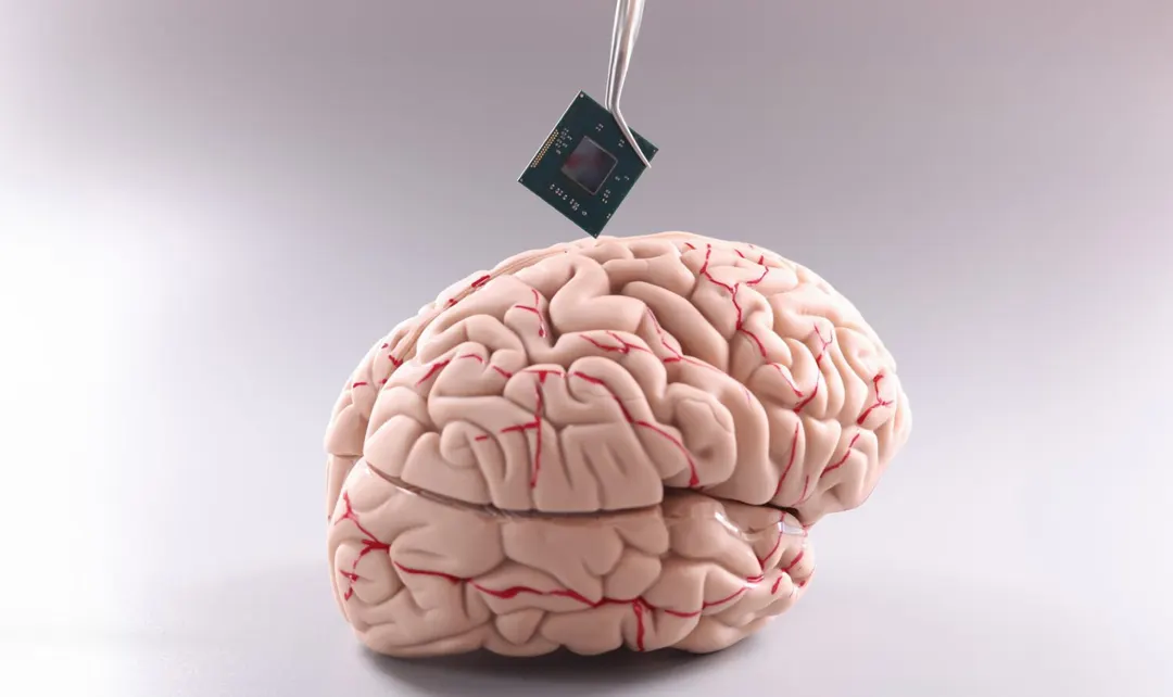 OpenAI and Founders Fund back Coherence Neuro's $45M brain implant