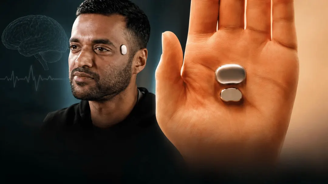 Deepinder Goyal's Temple wearable opens pre-orders November 1 at up to $1,000