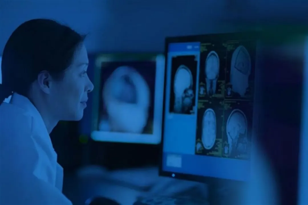 Japan targets 2nm medical AI chip with IBM design, Rapidus eyed for foundry
