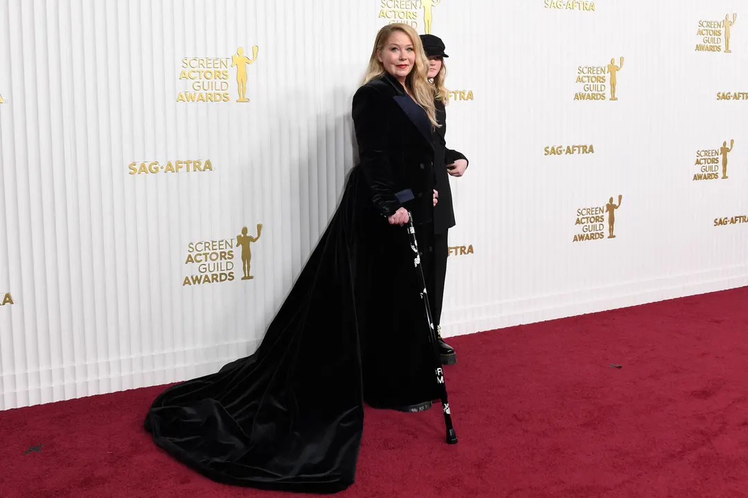 New brain-scanning tech revealed Christina Applegate's MS diagnosis was wrong