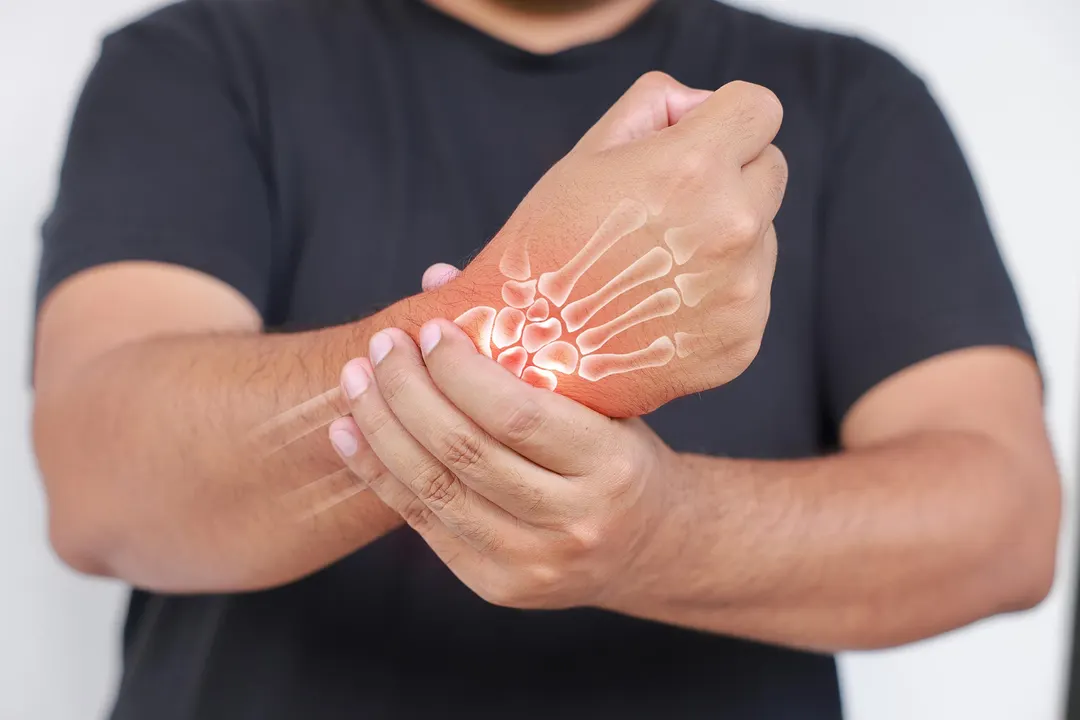 Stress May Reactivate Arthritis via Brown Fat and IL-6