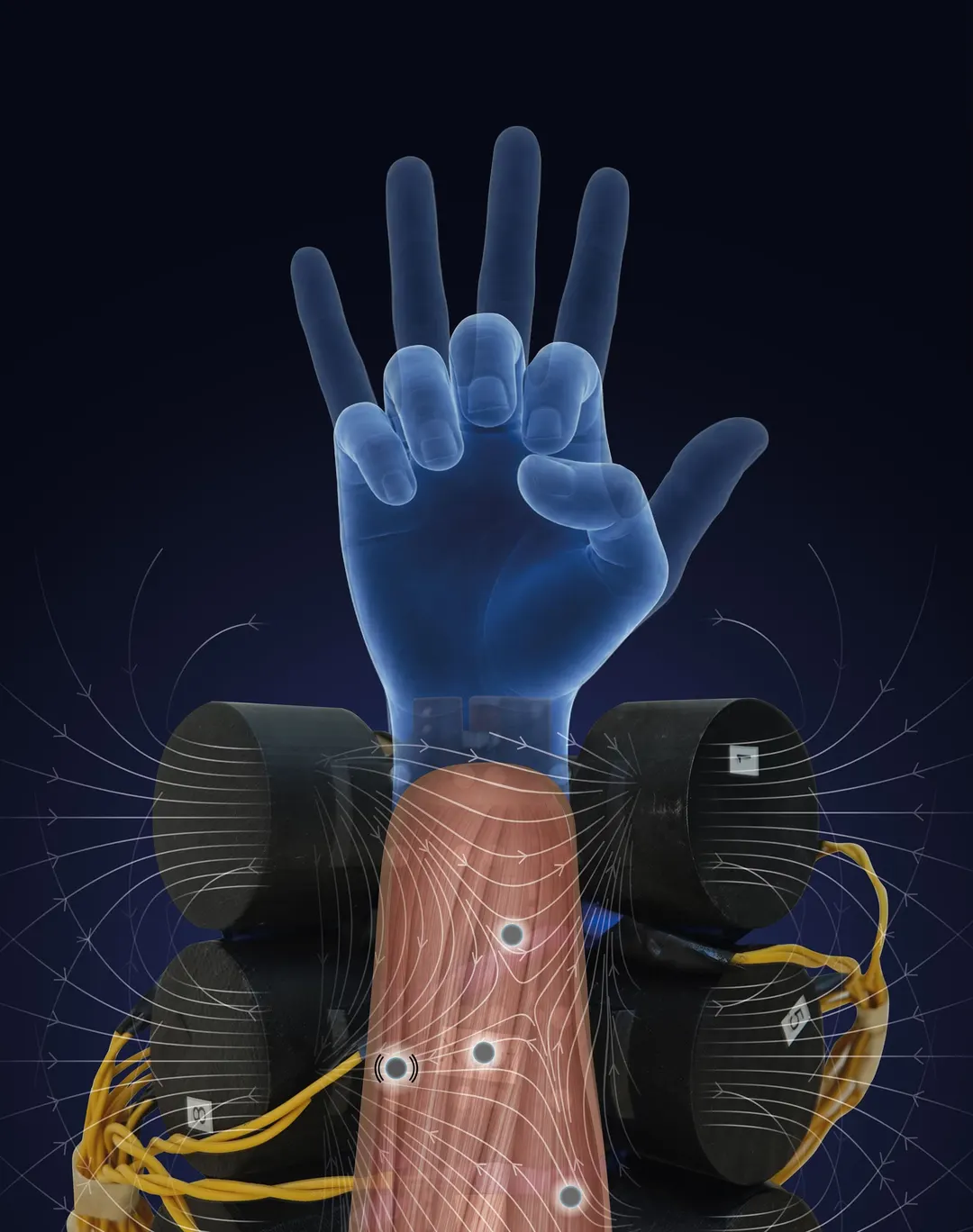 Magnets Implanted in Muscles Give Prosthetic Hand a Sense of Movement