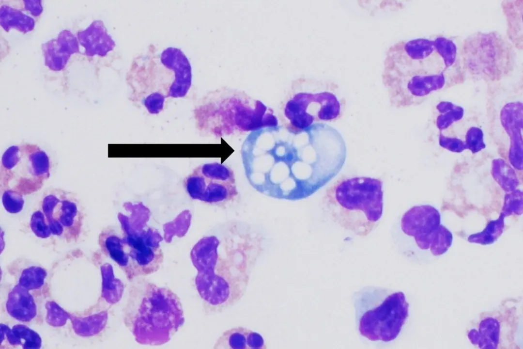 Marine Bacteria Compound Kills Brain-Eating Amoeba in Four Hours