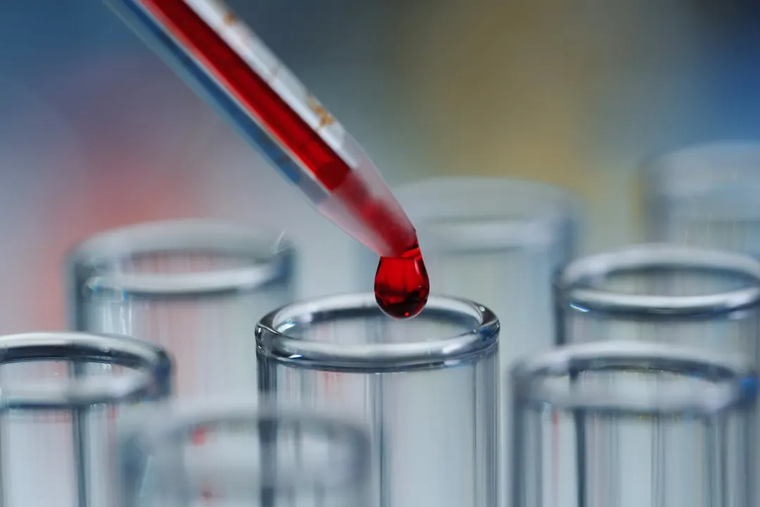 Routine blood test may predict dementia risk 15 years ahead