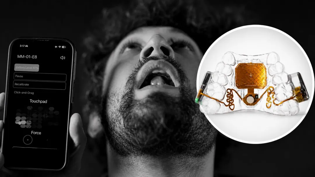 Augmental MouthPad controls devices with tongue for $1,400