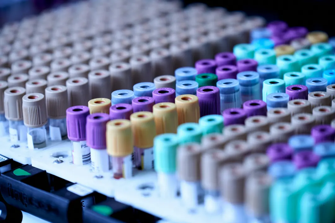 UK care home deploys first lab-free PCR test for UTI resistance genes in 60 minutes