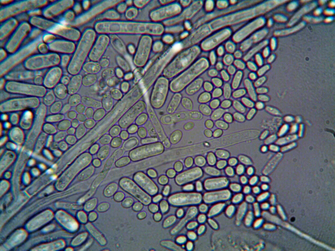 Wisconsin Rivers Near Dairy Farms Show 70% Multi-Drug-Resistant E. coli