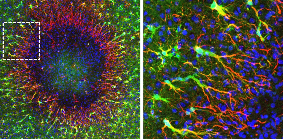 Scientists find astrocytes in mouse brains can repopulate damaged tissue