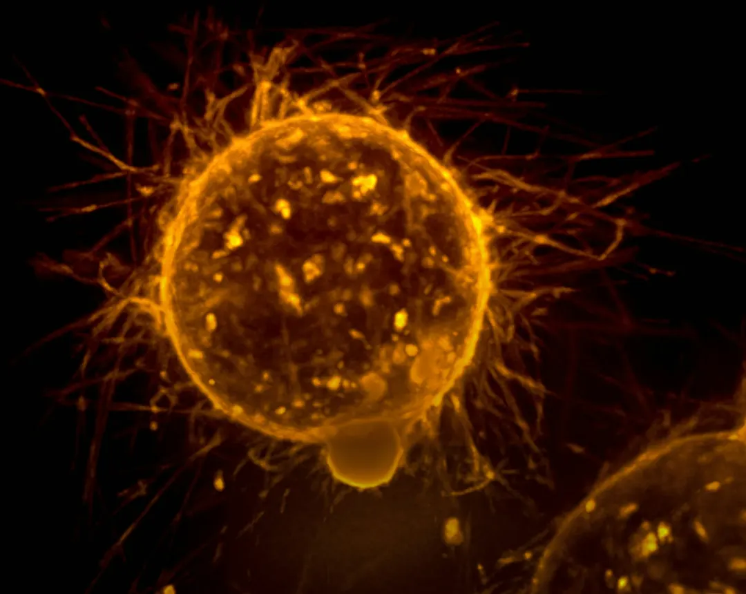 METTL13 enzyme drives KRAS overproduction and drug resistance