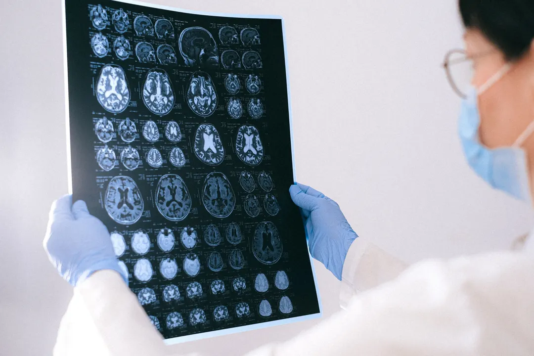 Swiss team turns Egyptian Blue into nanosheets for real-time brain imaging